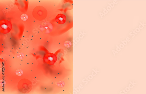 Texture, inflamed pimples and acne. Before After acne cysts. Skin background. Infographics. Vector illustration on isolated background.