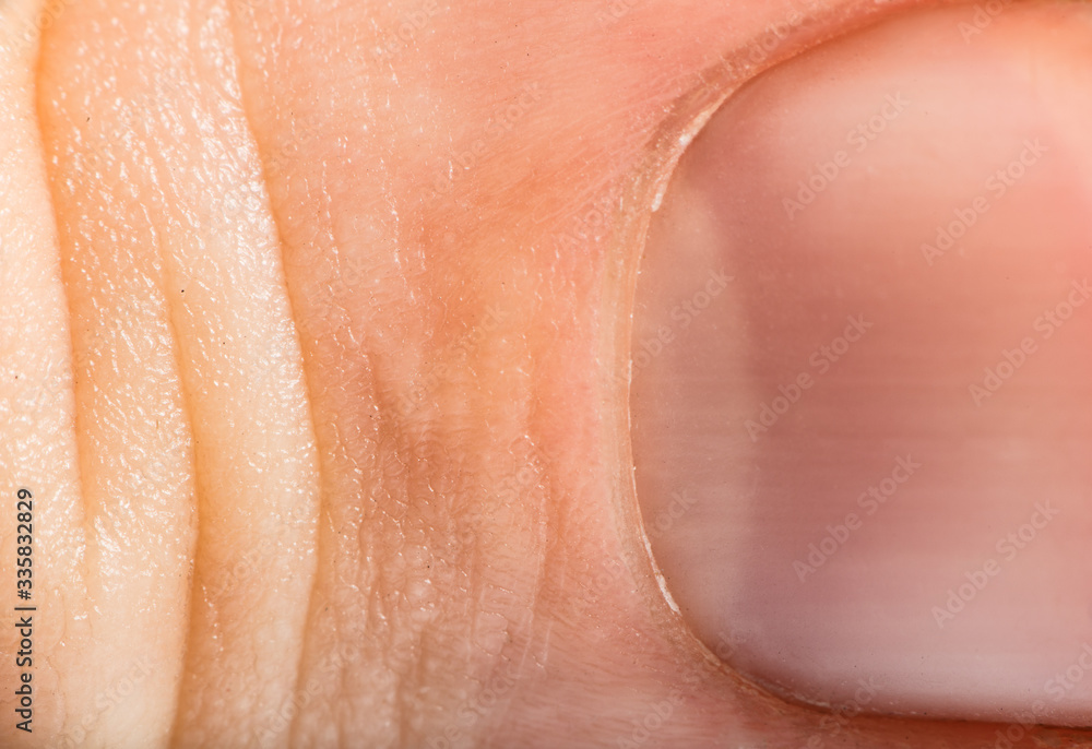 Fototapeta premium Close up human skin and claw. Macro epidermis