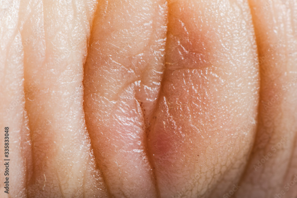 Close up human skin. Macro epidermis Close up human skin. Macro epidermis