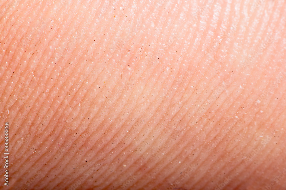 Close up human skin. Macro epidermis Close up human skin. Macro epidermis