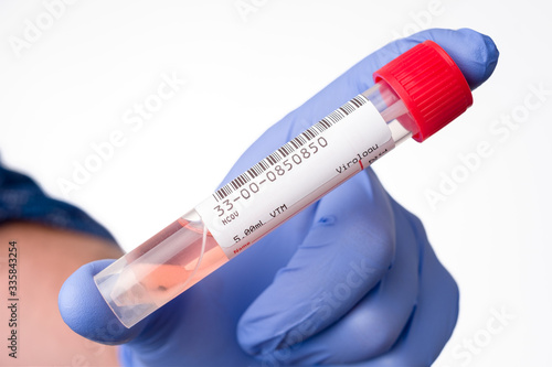 Real coronavirus SARS-CoV-2 test nasal and throat swab kit to test a patient showing symptom of COVID 19. Inside of the tube with of feeding medium for virus RNA