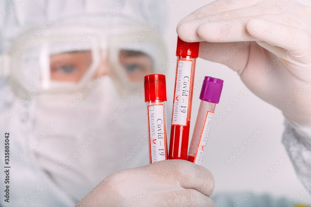 doctor man in flu mask and protective gloves holding a test tube with a coronavirus blood sample. Prevent flu disease Coronavirus. doctor man in flu mask and protective gloves holding a test tube with a coronavirus blood sample. Prevent flu disease Coronavirus.