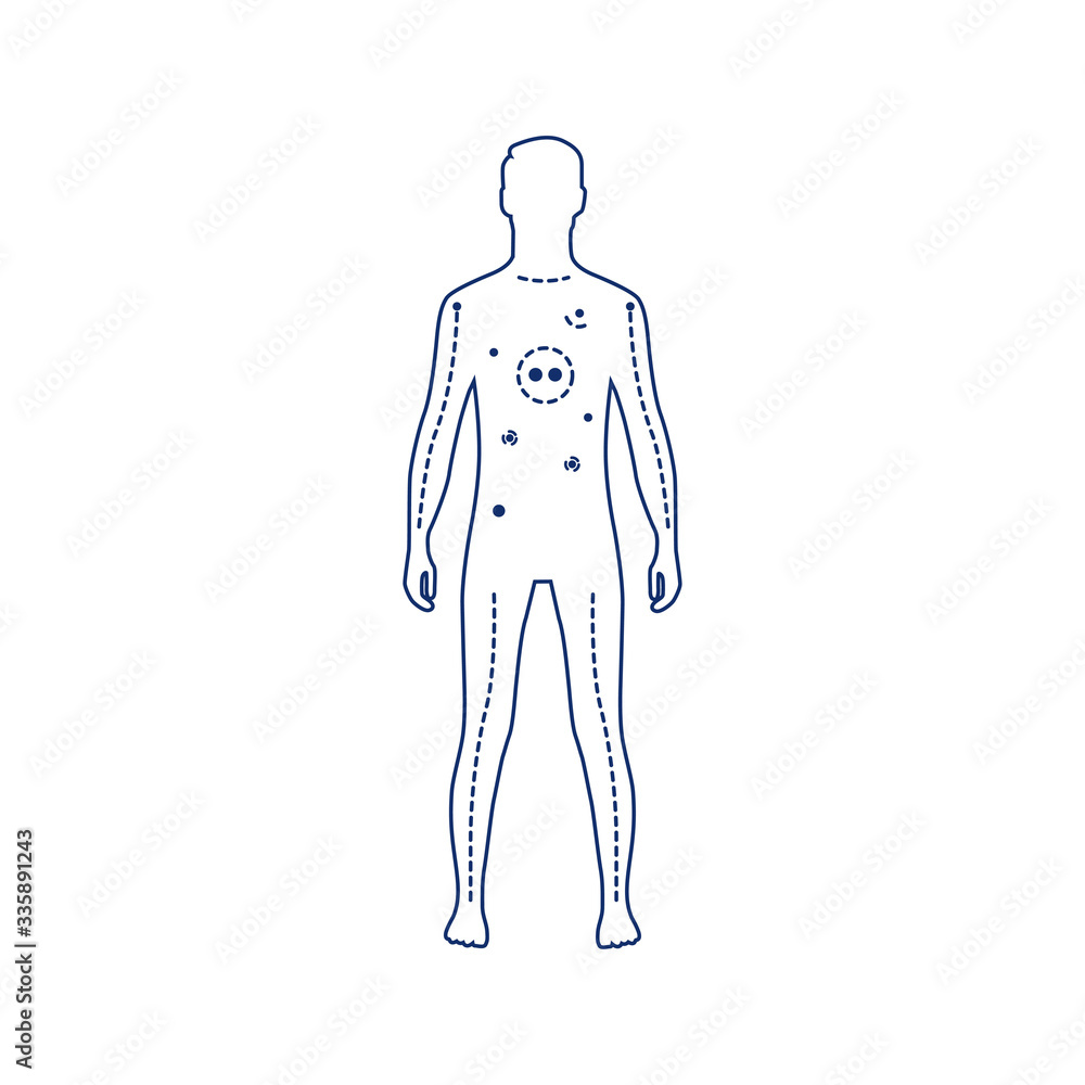 Artificial Life Support black line icon. Systems that use medical technology to aid, support, or replace a vital function of the body. Pictogram for web page, mobile app, promo. Editable stroke Artificial Life Support black line icon. Systems that use medical technology to aid, support, or replace a vital function of the body. Pictogram for web page, mobile app, promo. Editable stroke
