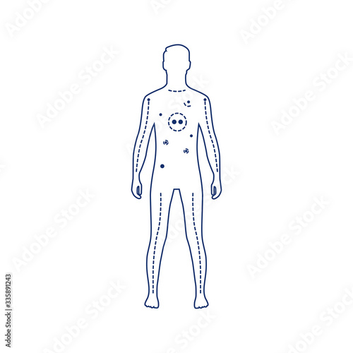 Artificial Life Support black line icon. Systems that use medical technology to aid, support, or replace a vital function of the body. Pictogram for web page, mobile app, promo. Editable stroke