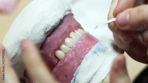 Dentist work on clayy mold human gums model in jaws prothetic laboratory, close-up photo