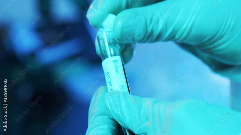 Blood and virus in the laboratory tube. Close-up of scientific lab in clinics. Pandemic disease, healthcare, vaccine research and coronavirus covid-19 test. Blood and virus in the laboratory tube. Close-up of scientific lab in clinics. Pandemic disease, healthcare, vaccine research and coronavirus covid-19 test.