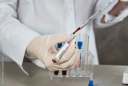 Positive COVID-19  SARS-COv2 test and laboratory sample of blood testing for diagnosis new Coronavirus infection..