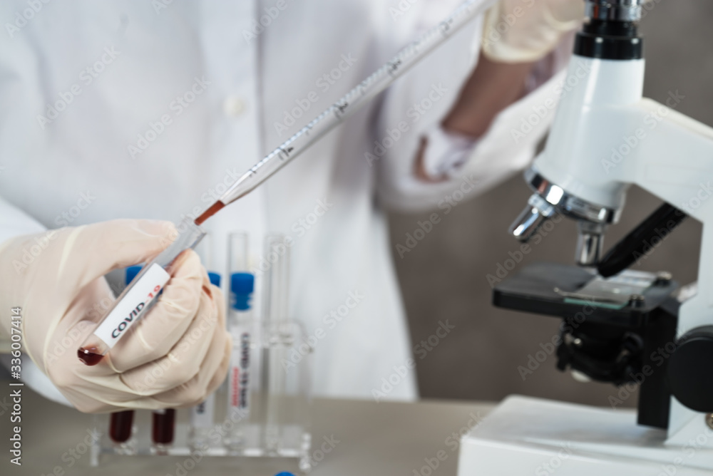 Positive COVID-19, SARS-COv2 test and laboratory sample of blood testing for diagnosis new Coronavirus infection.. Positive COVID-19, SARS-COv2 test and laboratory sample of blood testing for diagnosis new Coronavirus infection..