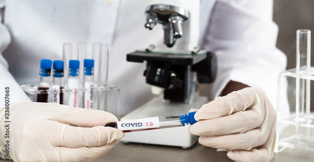 Fototapeta premium Positive COVID-19, SARS-COv2 test and laboratory sample of blood testing for diagnosis new Coronavirus infection..