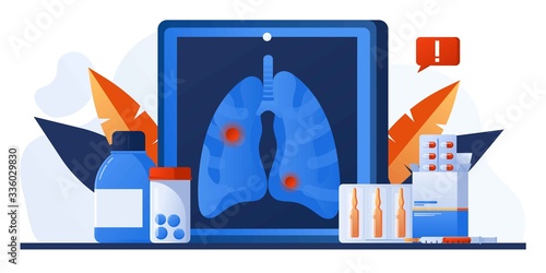 Examination patients lungs with tuberculosis, lung cancer, asthma diseases, coronavirus, infection. Pulmonology or respiratory medicine. Pharmacy, drugs and pills. Chest x-ray. Lung radiography image