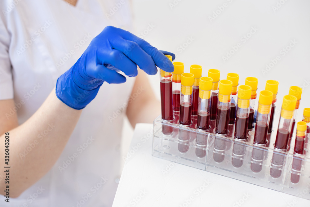 A woman's hand in a blue glove holding a blood sample in a laboratory test tube to detect viruses A woman's hand in a blue glove holding a blood sample in a laboratory test tube to detect viruses