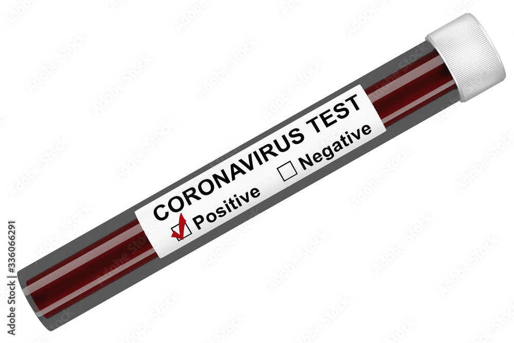 3d render test tube with blood with a positive result for a coronavirus originating from Wuhan, China 3d render test tube with blood with a positive result for a coronavirus originating from Wuhan, China