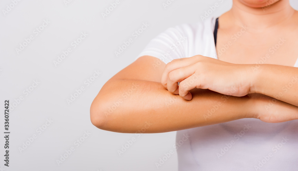 Asian beautiful woman itching her useing hand scratch itch Arm Asian beautiful woman itching her useing hand scratch itch Arm