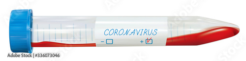 Blood test on coronavirus in microbiological tube