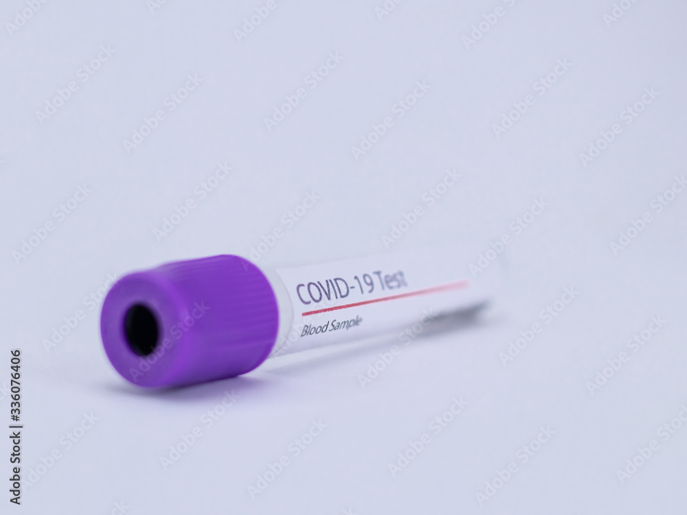 CLose up shot of an empty blood sample collection tube for Coronavirus or COVID 19 test. CLose up shot of an empty blood sample collection tube for Coronavirus or COVID 19 test.
