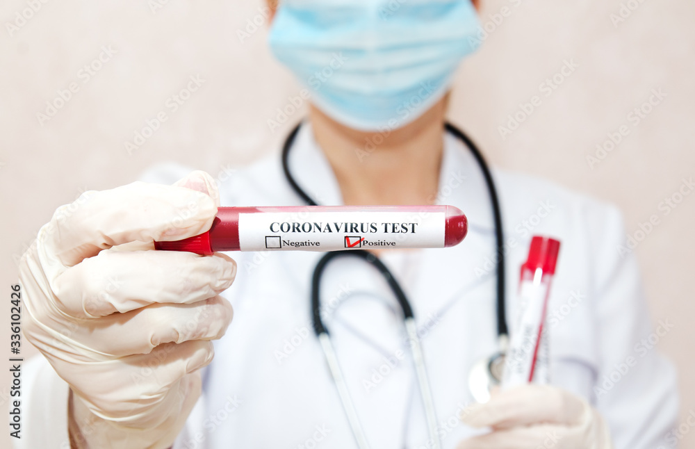 Nurse holding test tube with blood for 2019-nCoV analyzing