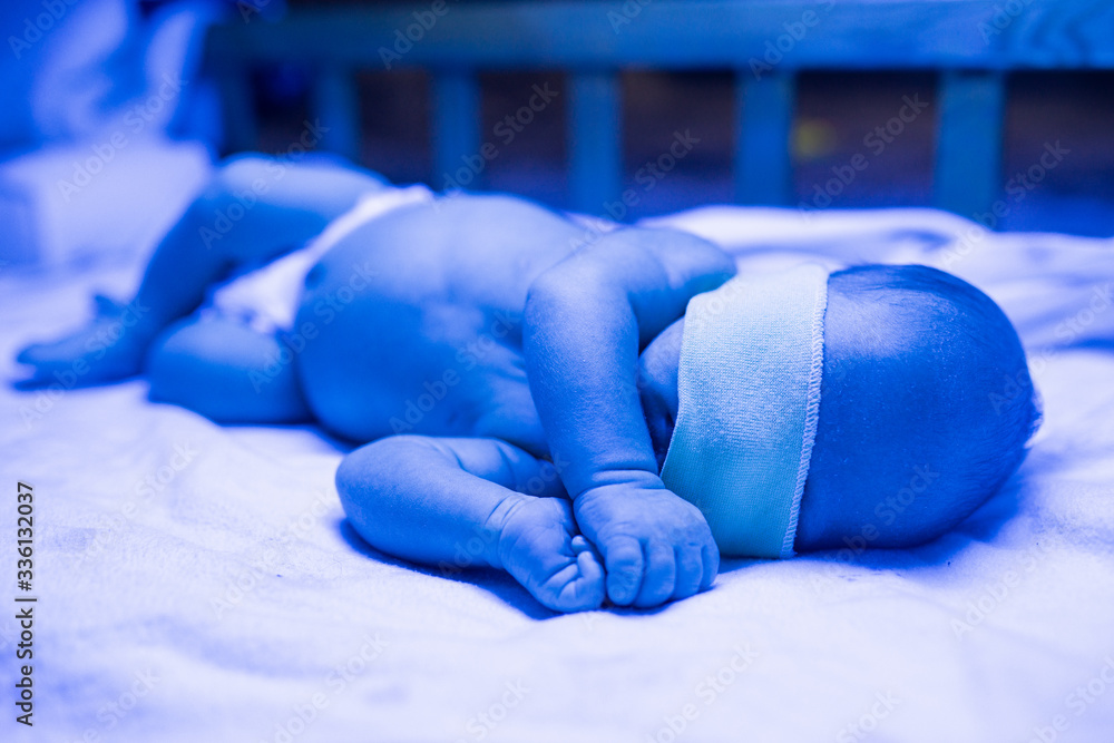 Newborn having a treatment for jaundice under ultraviolet light, Baby