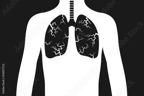 Pneumonia and lung cancer - disease and illness is damaging internal organ in human body. Health problem based on infection, virus, bacteria, tumor and carcinoma. Vector illustration.