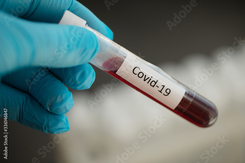 Medical equipment. Blood test. Covid-19. Corona virus.