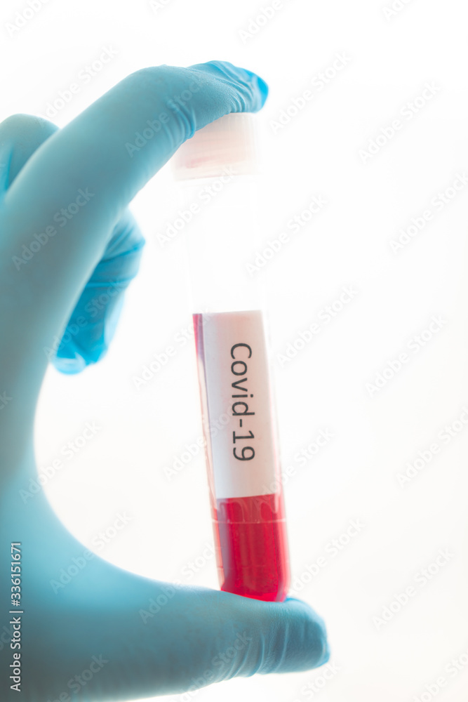 Test tube with blood sample for COVID-19 test, novel coronavirus 2019 found in Wuhan, China. Test tube with blood sample for COVID-19 test, novel coronavirus 2019 found in Wuhan, China.