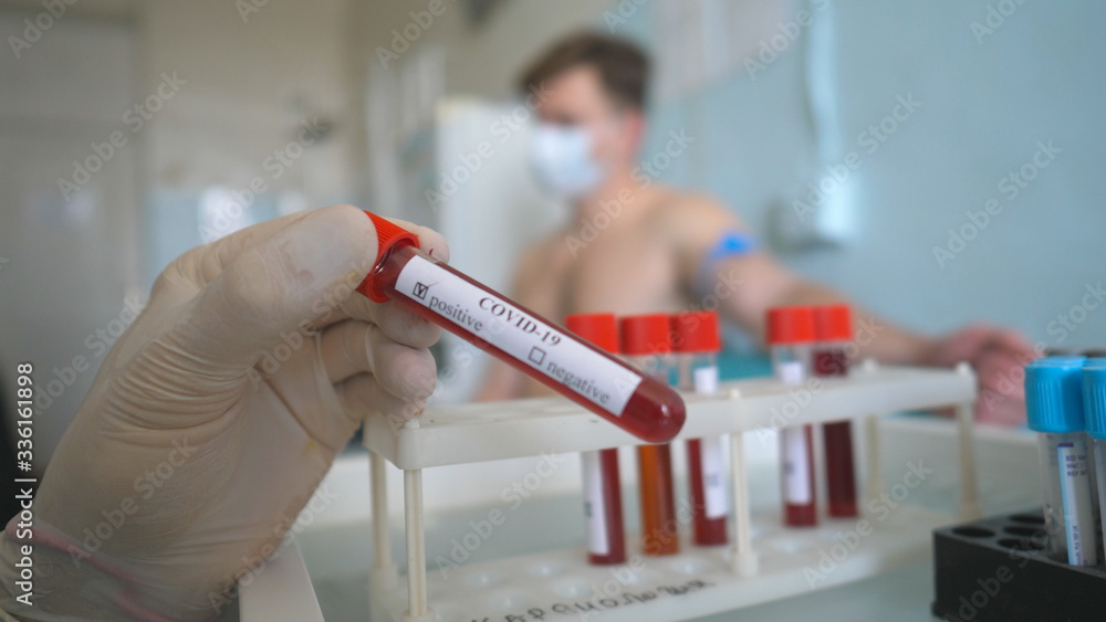 Hand of doctor marking as positive to COVID-19 a blood sample of patient at lab or hospital. Laboratory testing blood to corona virus. Concept of health and safety life from pandemic of coronavirus