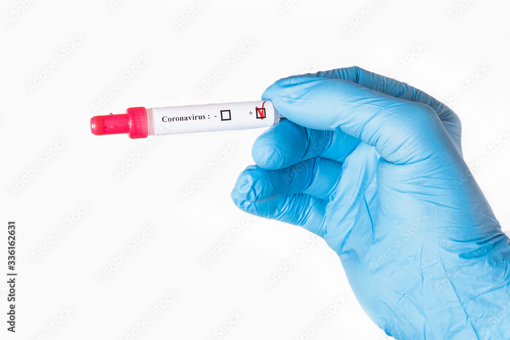 Obraz premium Test tube with a positive test for coronavirus