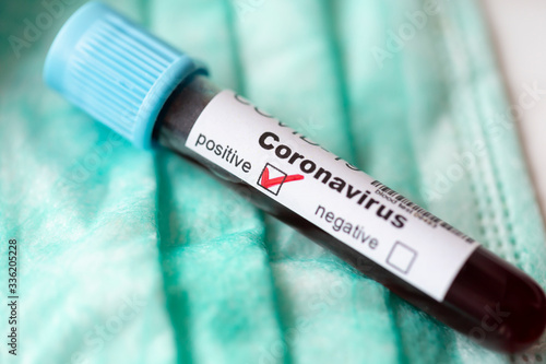 Blood sample positive for coronavirus infection