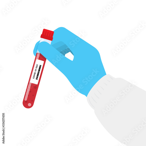 Hand holds a test tube containing a blood sample, test tube with blood for Covid-19