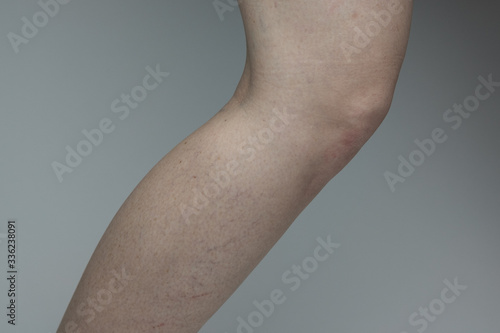 Canvas Print Close up of a woman slightly bending her knee against a gray background exposing