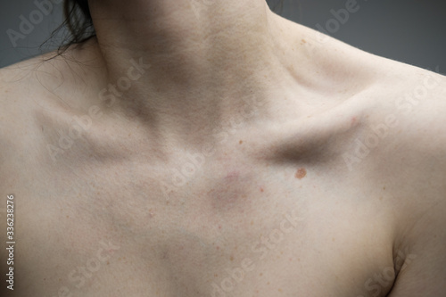 Woman with no face; stretching her neck and exposing her collar bones and décolletage; pale skin, freckles and moles