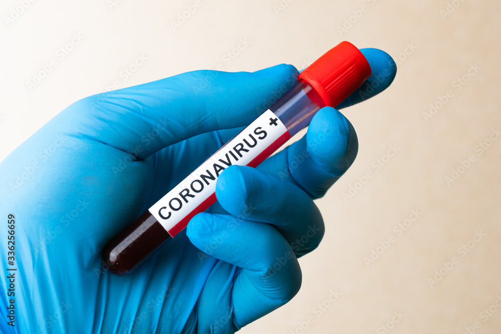 Naklejka premium Hand in glove hold positive Coronavirus blood test result