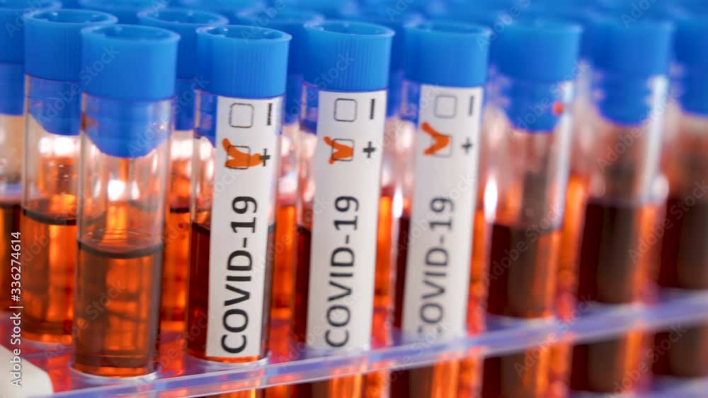 Test tubes filled with samples of the COVID-19 coronavirus pandemic Test tubes filled with samples of the COVID-19 coronavirus pandemic