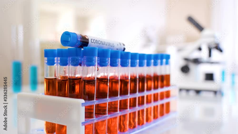 The test tube rack filled with COVID-19 coronavirus samples