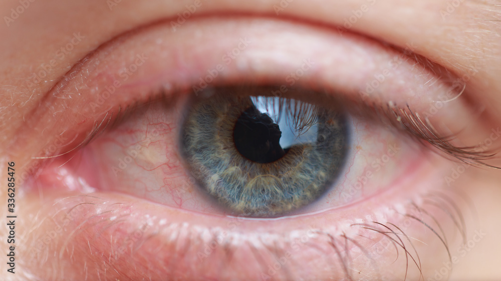 Fototapeta premium Eye veins red shape