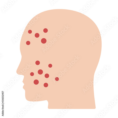 Acne or pimples on face flat vector color icon for medical apps and websites