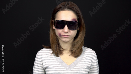 Young woman wearing sunglasses to close bruises on her face. A woman with bruises on her face. Quarrel in a young family. Domestic violence. On a black background