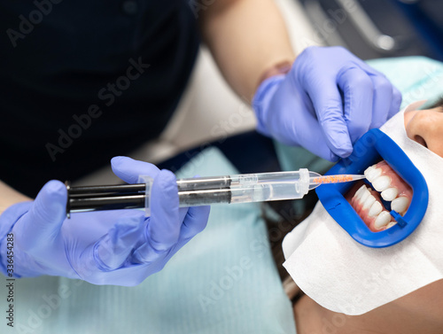 Doctor dentist performs a procedure for whitening teeth with a special gel from a syringe. Dentistry and orthodontics.