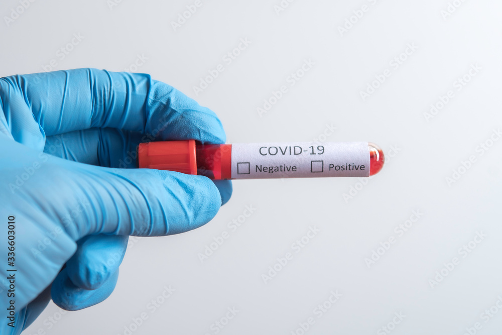 Fototapeta premium Blood sample tube positive with COVID-19 virus or novel coronavirus 2019 found in Wuhan, China