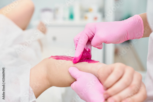 Depilation and beauty concept - beautician waxing young woman with liquid sugar at spa. depilation with colored shugaring paste
