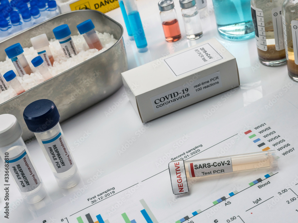 Novel coronavirus 2019 nCoV pcr diagnostics kit. This is RT-PCR kit to detect presence of 2019-nCoV or virus presence in clinical specimens, conceptual image