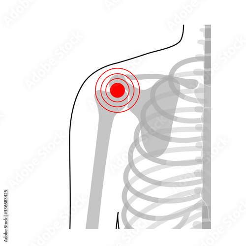 Human shoulder joint pain anatomy.