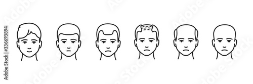Hair loss stage black line icon. Stages at which the amount of hair on a person s head gradually decreases. Pictogram for web page, mobile app, promo. UI UX GUI design element. Editable stroke
