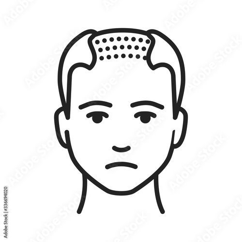 Man with a bald head black line icon. Baldness stage. Alopecia. Pictogram for web page, mobile app, promo. UI UX GUI design element. Editable stroke.