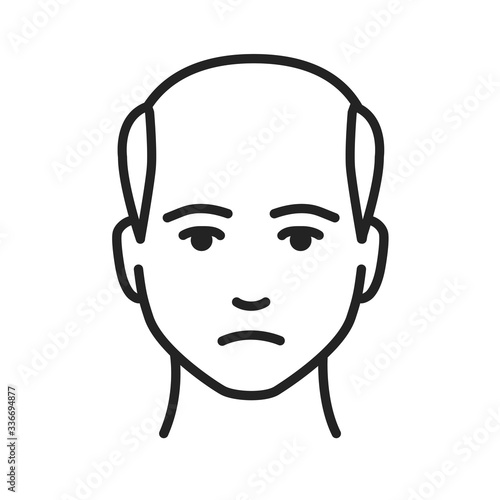 Man with a bald head black line icon. Baldness stage. Alopecia. Editable stroke.
