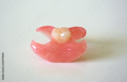 Removable denture type Butterfly on a light background. Replacement of one missing tooth. Closeup.