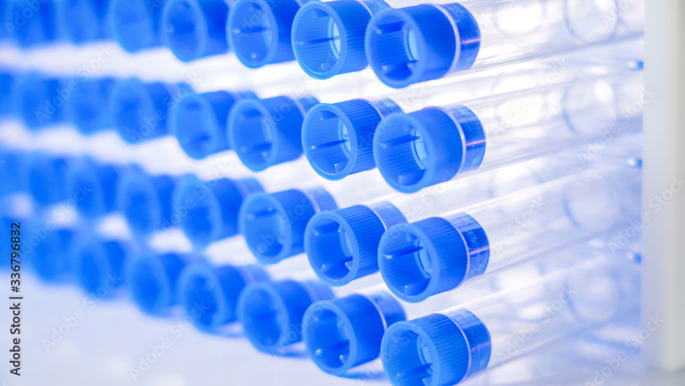 Row of the blue covered test tubes in the laboratory Row of the blue covered test tubes in the laboratory