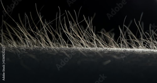 Goosebumps Hair Standing Up with Black Background photo