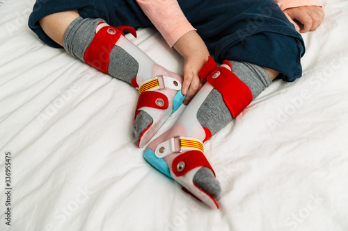 pies de un niño de 5 años con férulas ortopédicas para poder aprender ha andar, sujeción de los pies, prótesis pierna. la madre o fisioterapeuta se los está poniendo para los ejercicios terapéuticos.