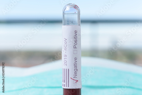 A blood vial in front of a medical mask. The label on the vial states 2019 n Cov, the words positive negative. It also contains the Greek flag. 