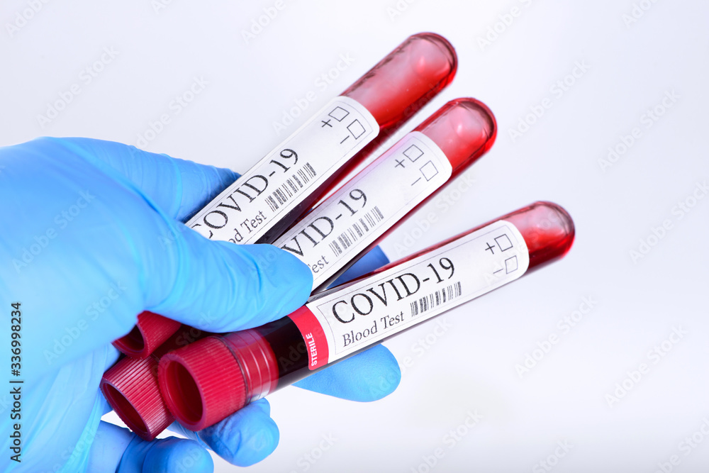 Obraz premium COVID-19 test and laboratory sample of blood isolated on white